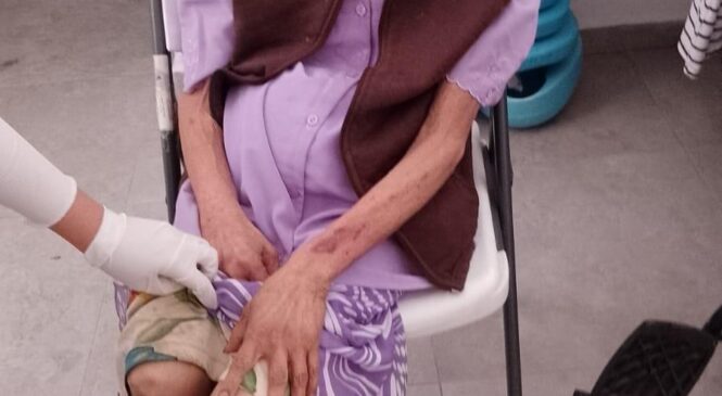 POLICÍAS DE ECATEPEC RESCATAN A ADULTA MAYOR EN ESTADO DE ABANDONO