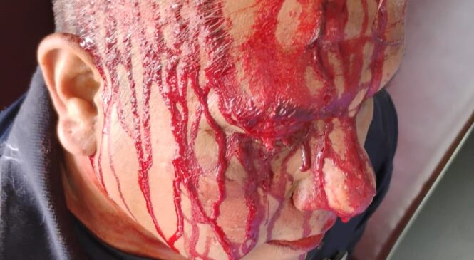 POLICÍAS DE HUXQUILUCAN SON AGREDIDOS CON PIEDRAS Y PALOS AL TRATAR DE AUXILIAR ANTE AMOTINAMIENTO EN EL PLANTEL 198 DEL CONALEP